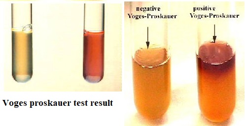 voges proskauer test