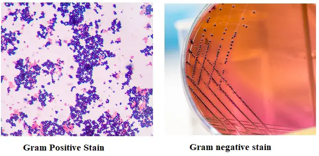 gram positive gram negative bacteria